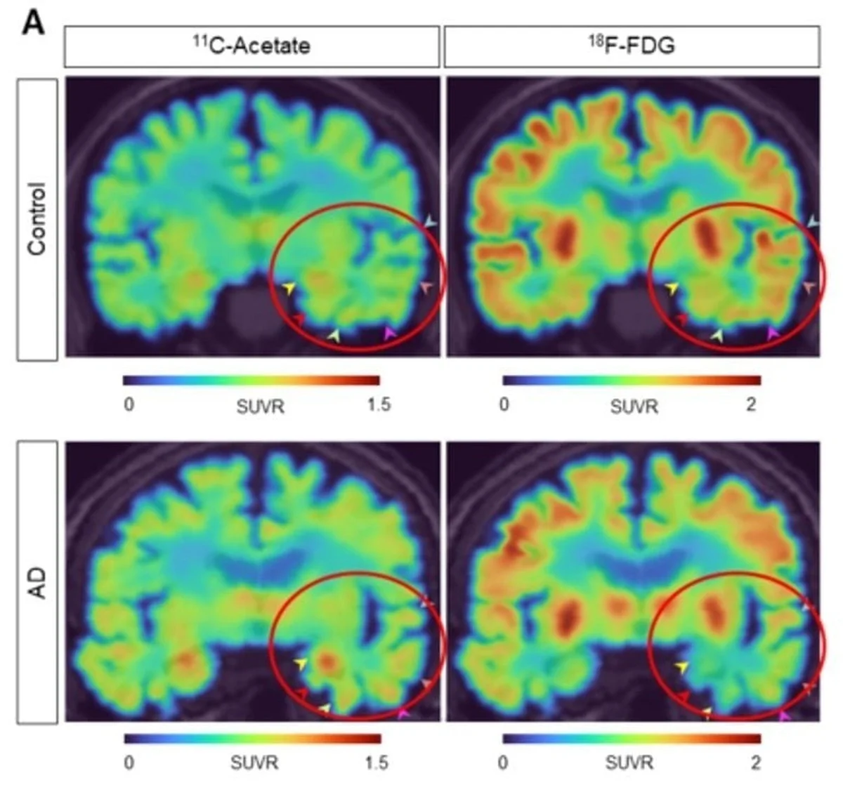 Vědci zvrátili Alzheimerovu chorobu u myší a obnovili jim paměť: Jak NAD+ ztěžuje mozek - image 2