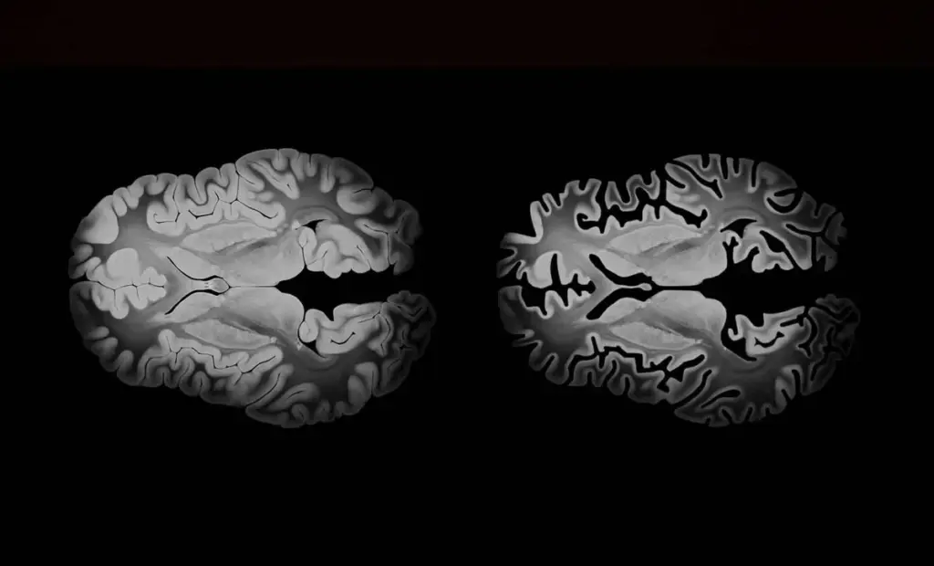 Proč vaše paměť najednou selhává: Odhalení vědců