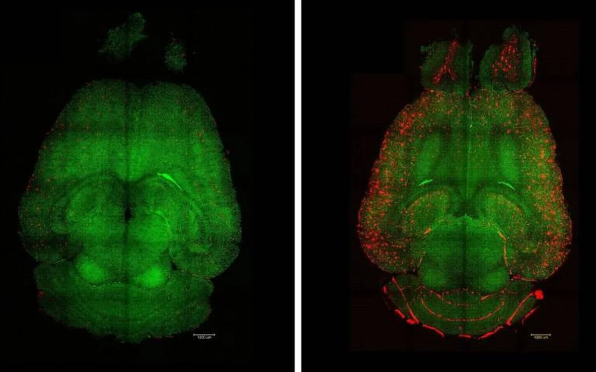 Proč zkušení neurovědci vkládají speciální látku do modelů Alzheimerovy choroby - image 1